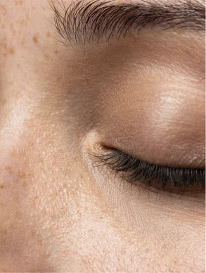 Anti-Pigmentation Skincare Bundle - Marcival Hill