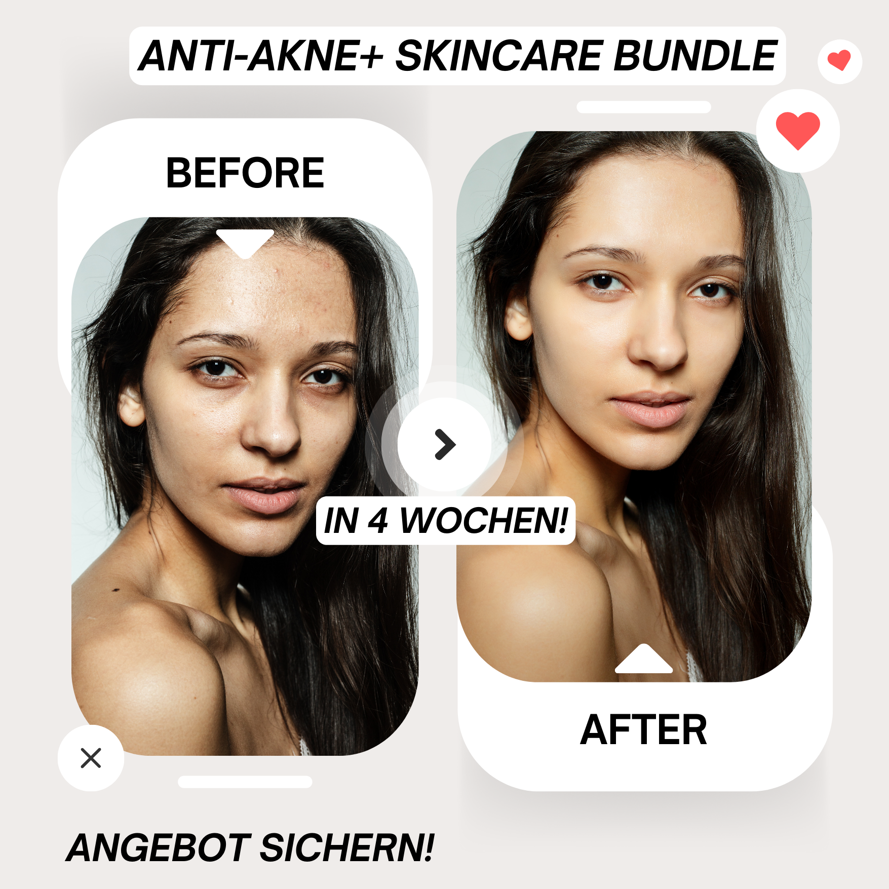 Anti-Acne+ Skincare Bundle (Clear Skin in 2 Weeks) - Marcival Hill