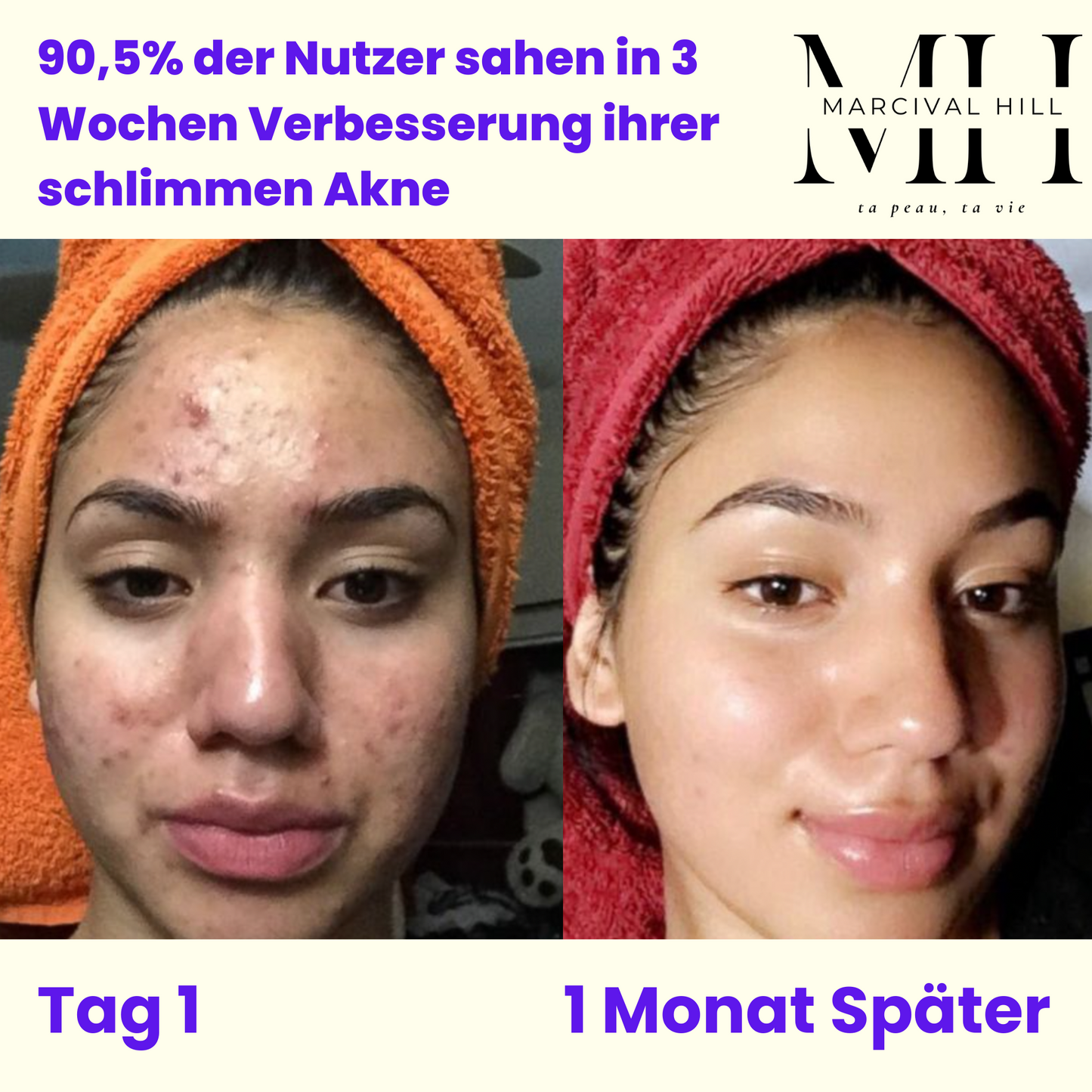 Easy Skincare Routine