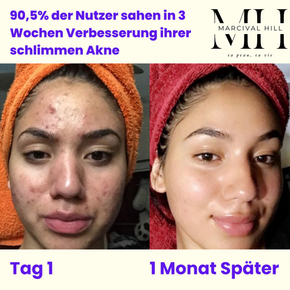 Easy Skincare Routine