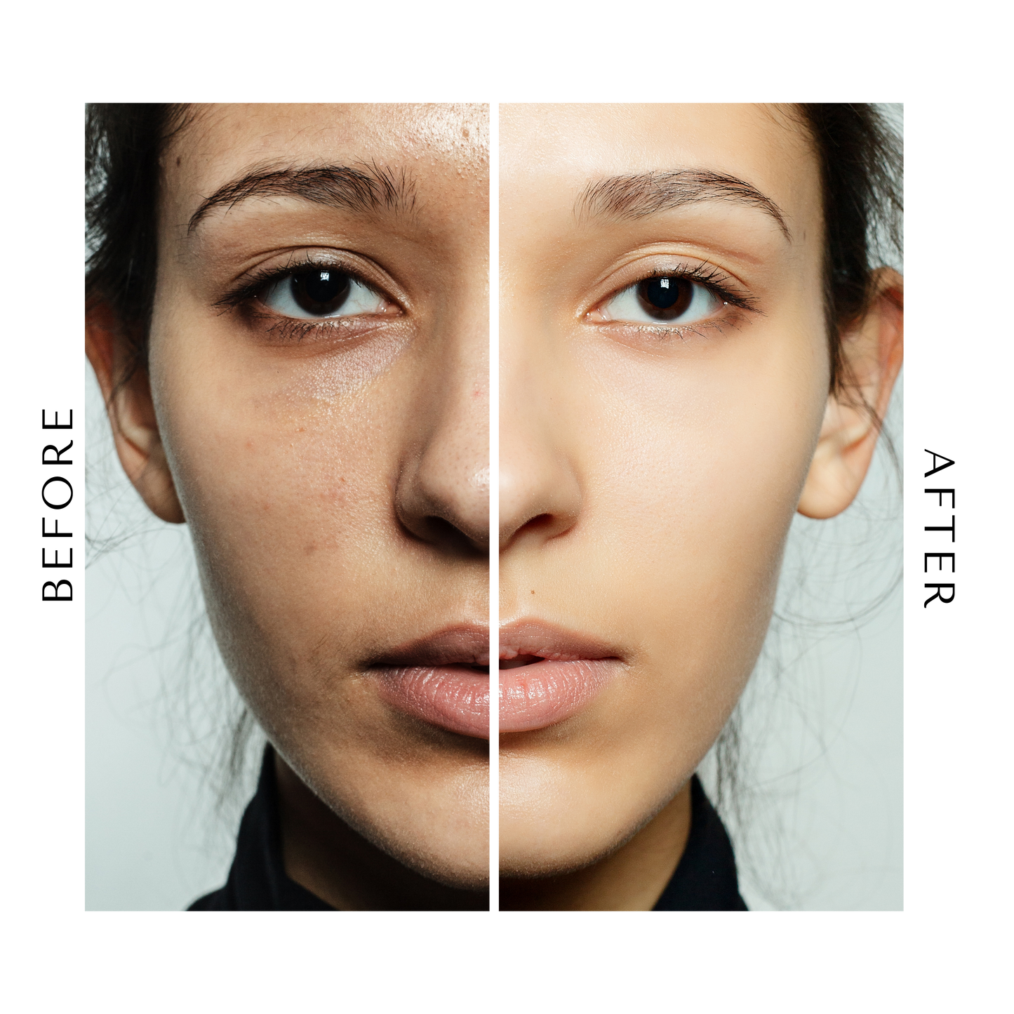 Super Anti-Breakout Serum | with BHA, Tea Tree Oil & Antioxidants